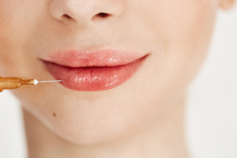 Quando fazer seu preenchimento labial?
